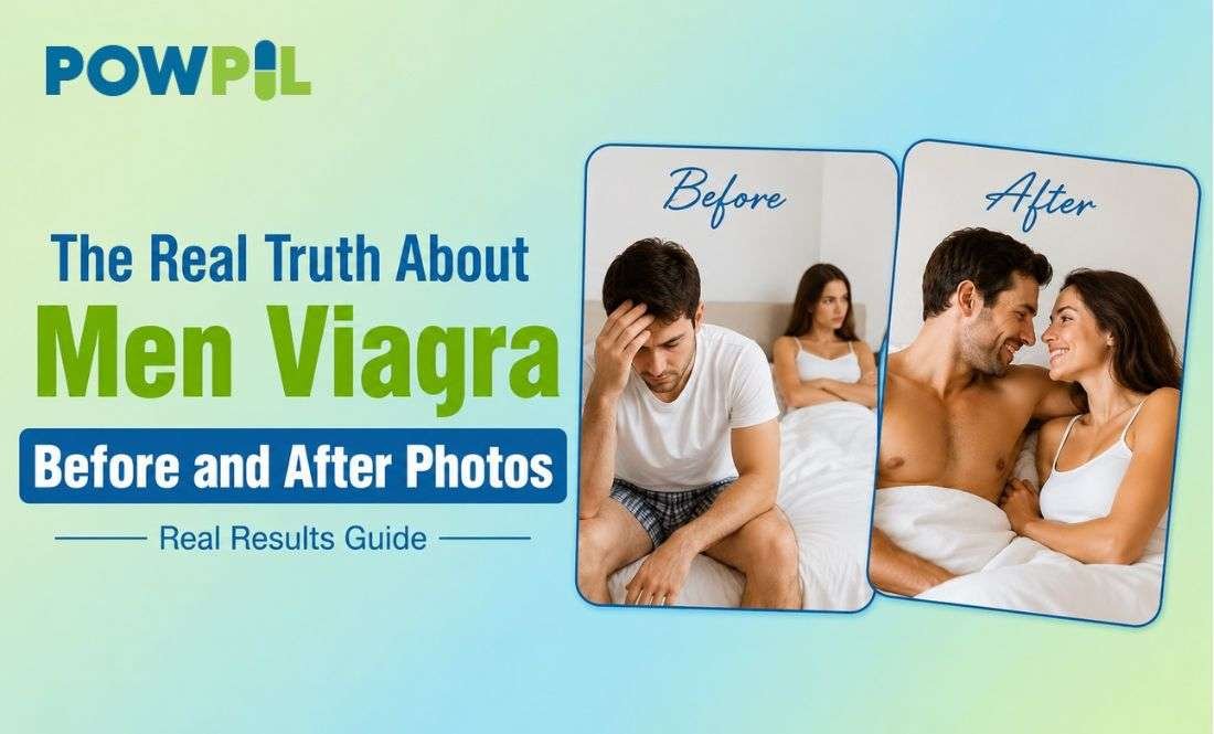 The Real Truth About Men Viagra Before and After Photos 1 Men Viagra Before and After Photos