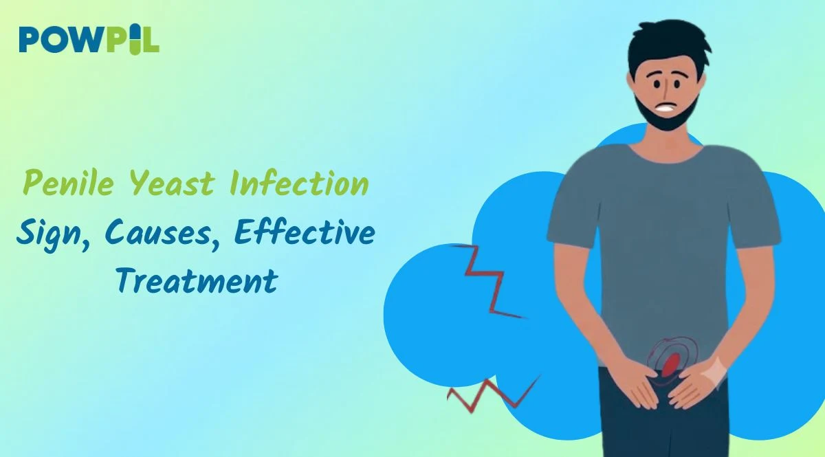 Penile Yeast Infection: Sign, Causes, Effective Treatment 1 Penile Yeast Infection Sign, Causes, Effective Treatment